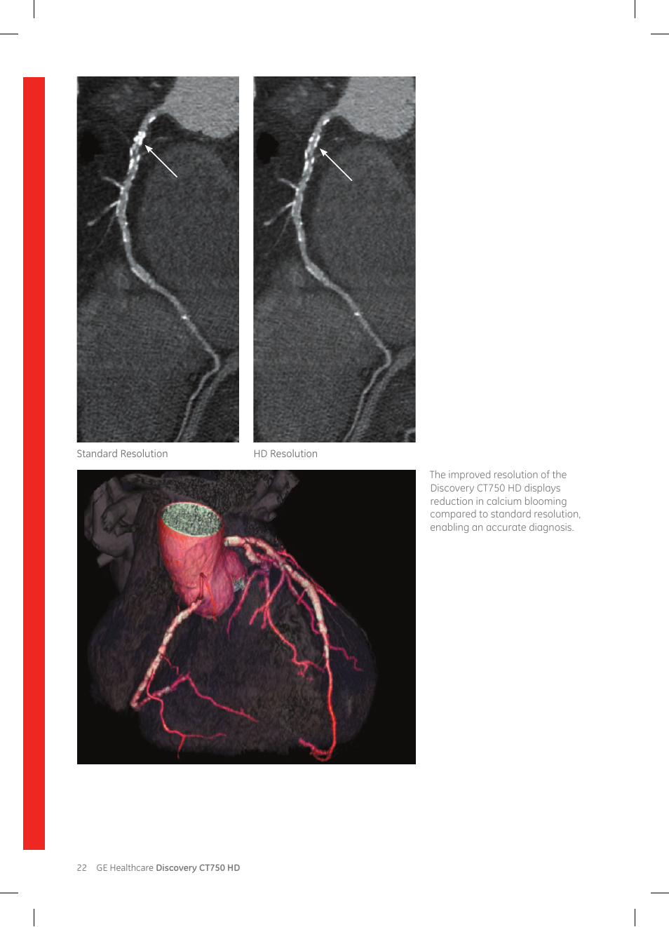 GE Healthcare Discovery CT750 HD User Manual | Page 22 / 49