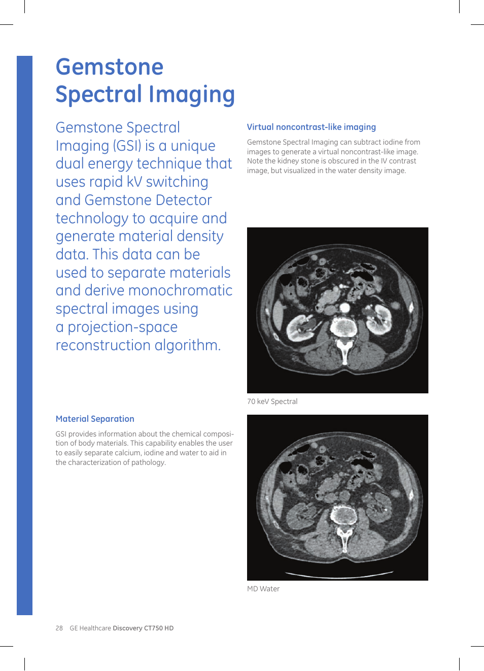 Gemstone spectral imaging | GE Healthcare Discovery CT750 HD User Manual | Page 28 / 49