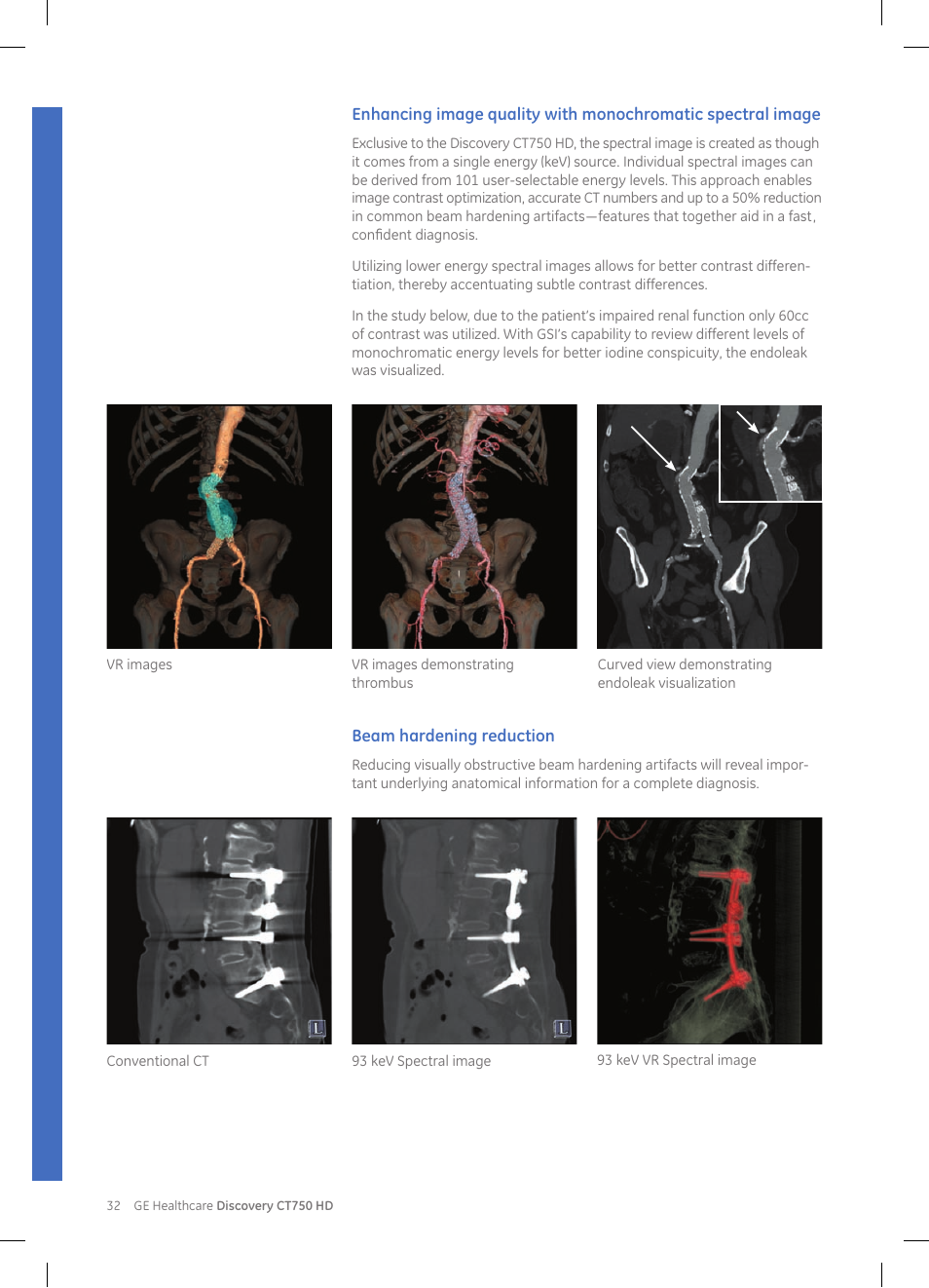 GE Healthcare Discovery CT750 HD User Manual | Page 32 / 49