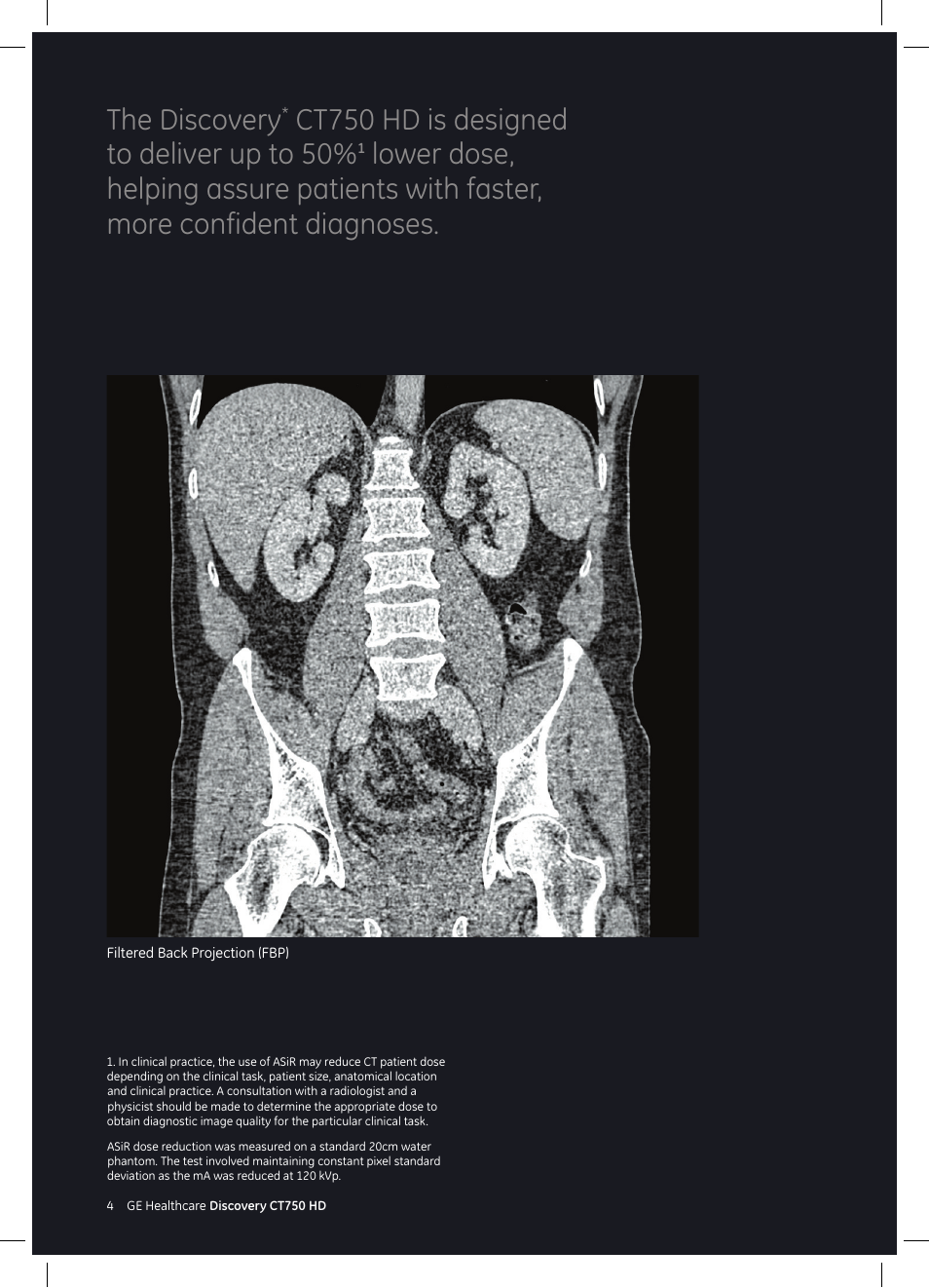 The discovery | GE Healthcare Discovery CT750 HD User Manual | Page 4 / 49