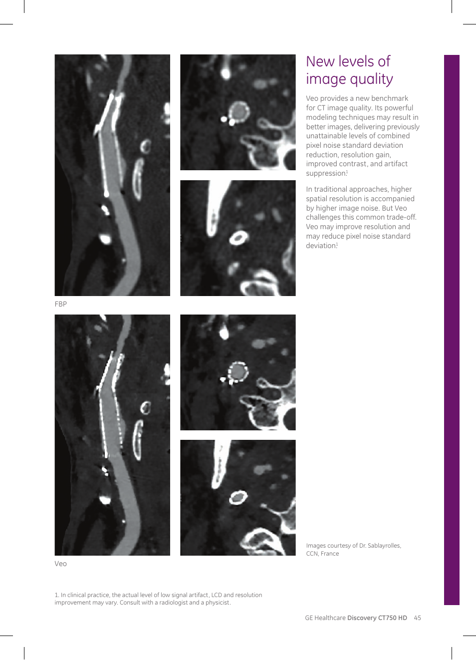 New levels of image quality | GE Healthcare Discovery CT750 HD User Manual | Page 45 / 49