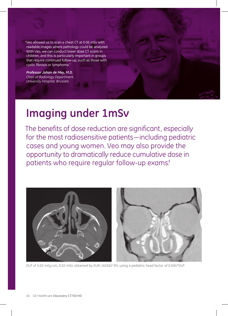 Imaging under 1msv | GE Healthcare Discovery CT750 HD User Manual | Page 46 / 49