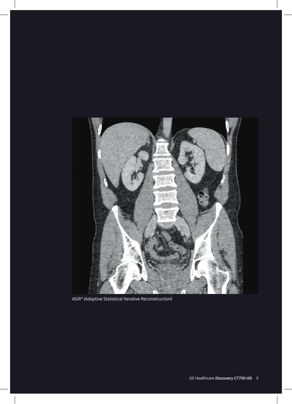 GE Healthcare Discovery CT750 HD User Manual | Page 5 / 49