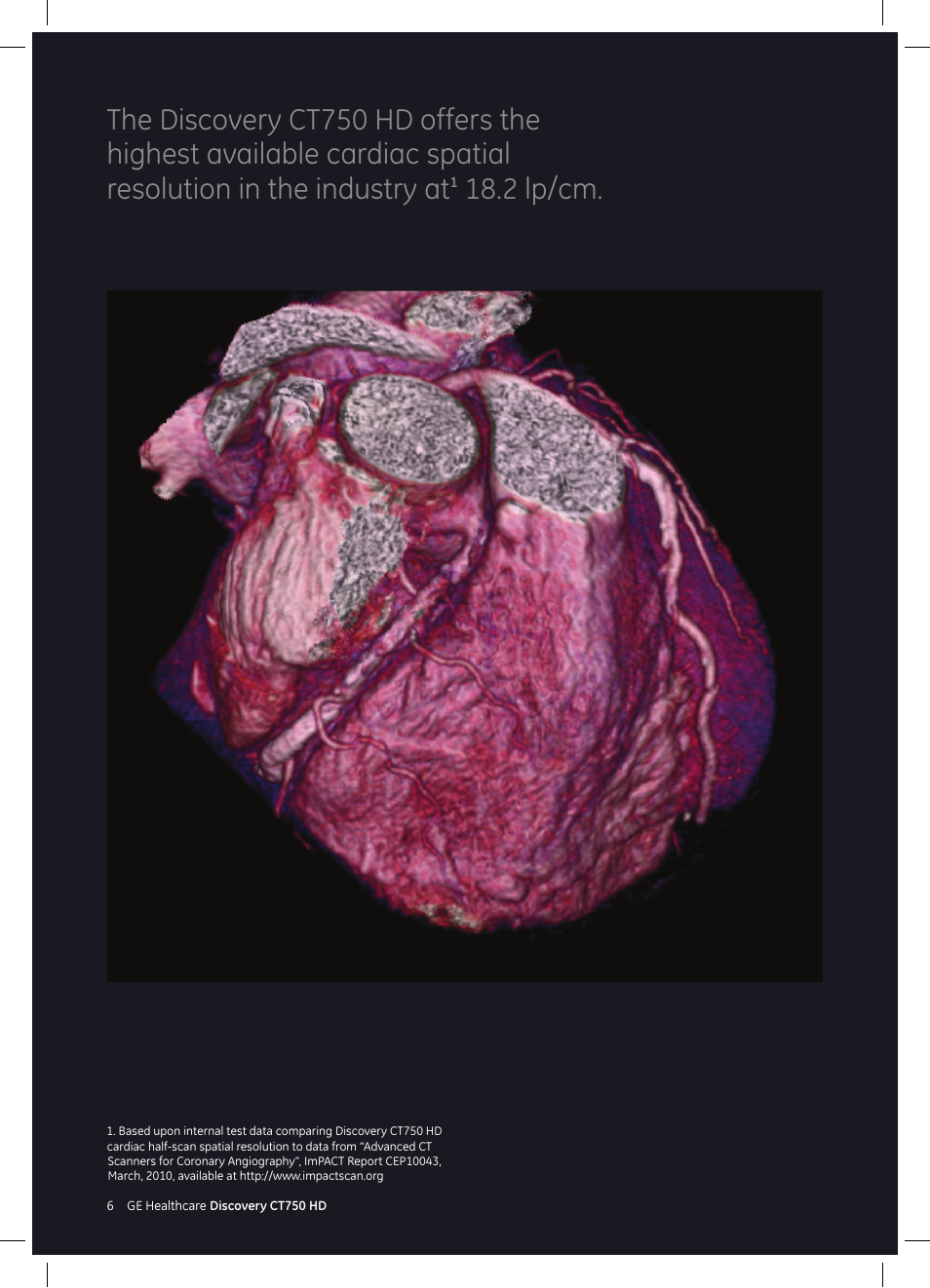 2 lp/cm | GE Healthcare Discovery CT750 HD User Manual | Page 6 / 49