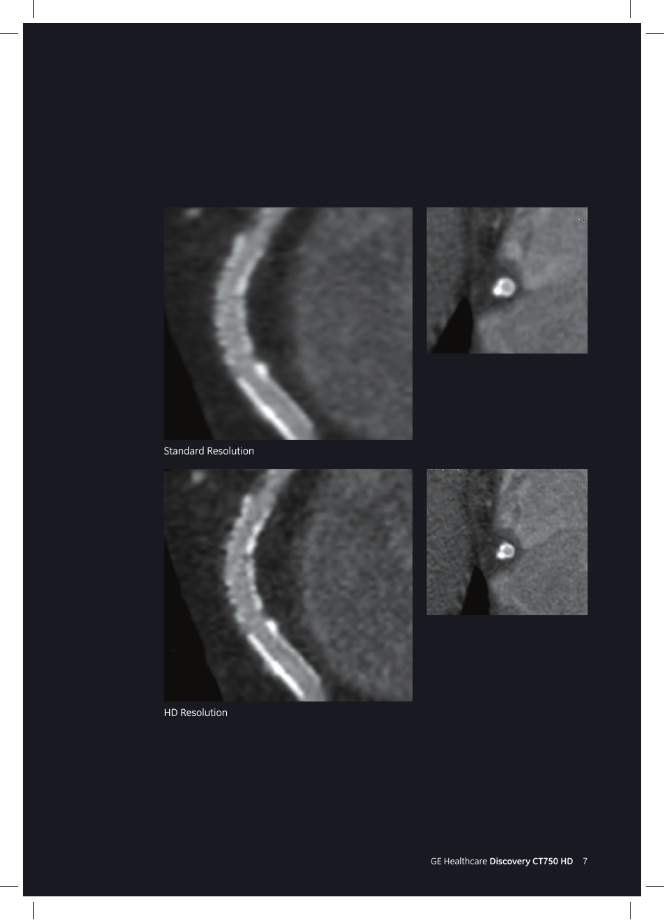 GE Healthcare Discovery CT750 HD User Manual | Page 7 / 49