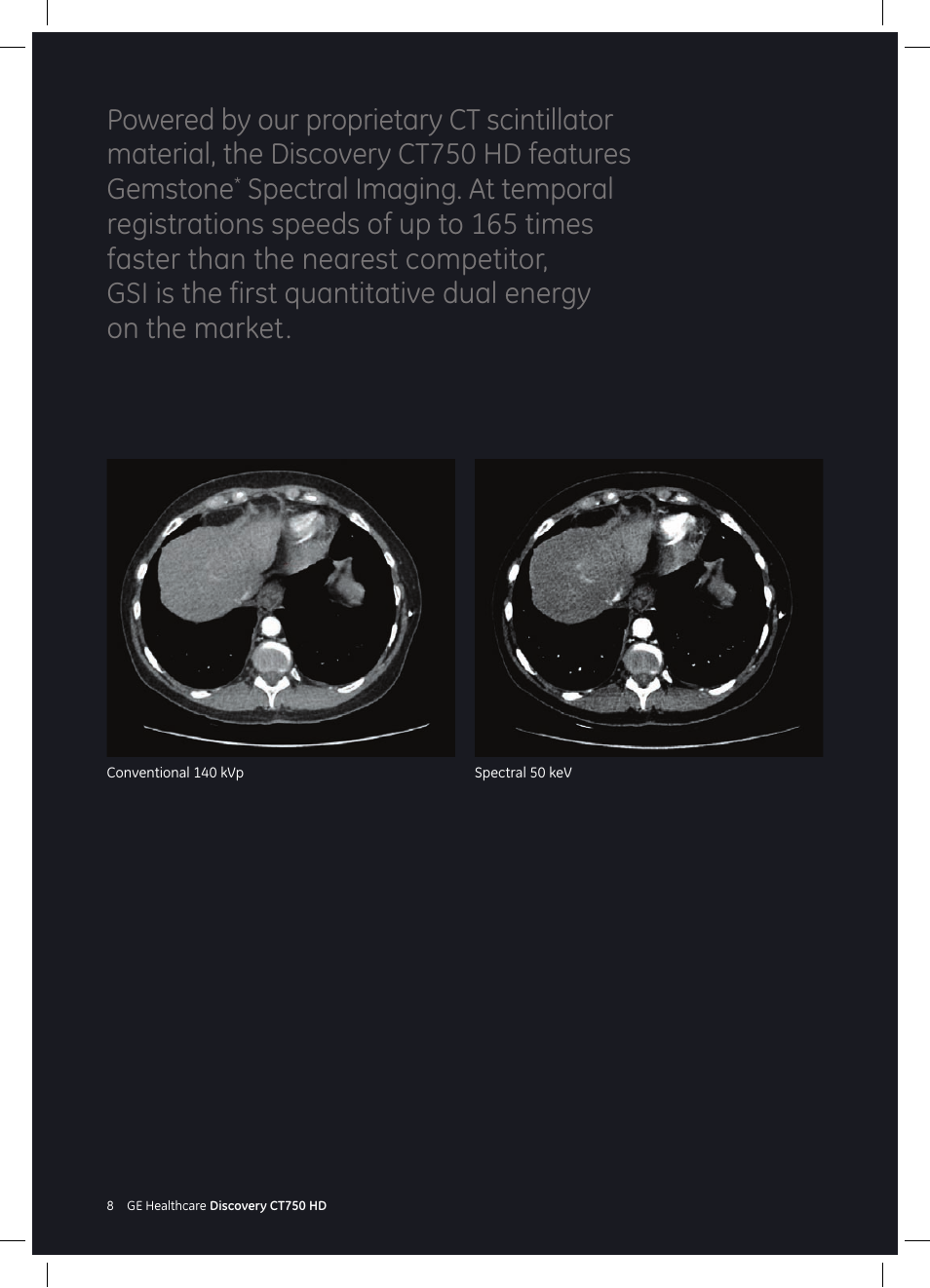 GE Healthcare Discovery CT750 HD User Manual | Page 8 / 49