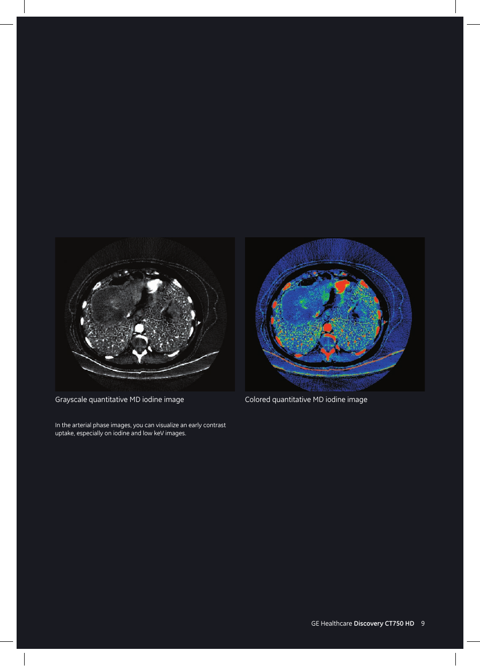 GE Healthcare Discovery CT750 HD User Manual | Page 9 / 49