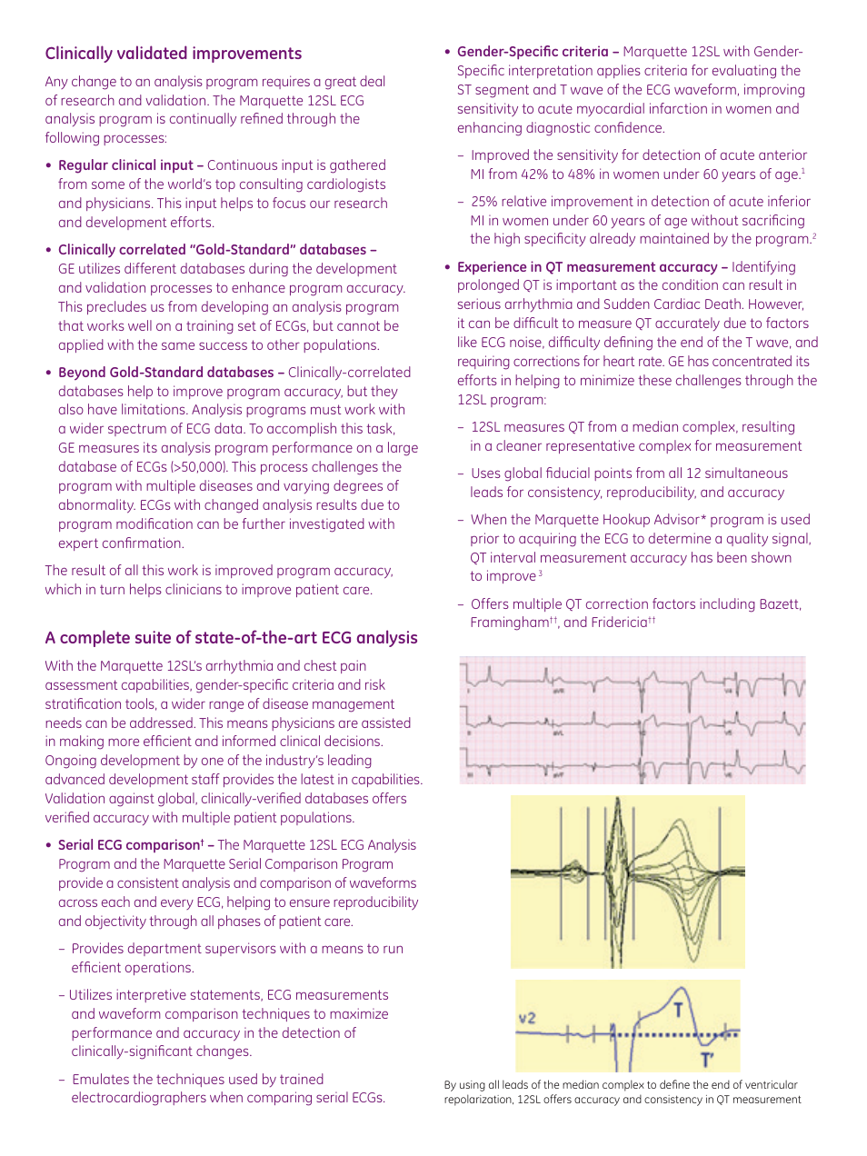 Clinically validated improvements, A complete suite of state-of-the-art ecg analysis | GE Healthcare Marquette 12SL ECG User Manual | Page 2 / 4