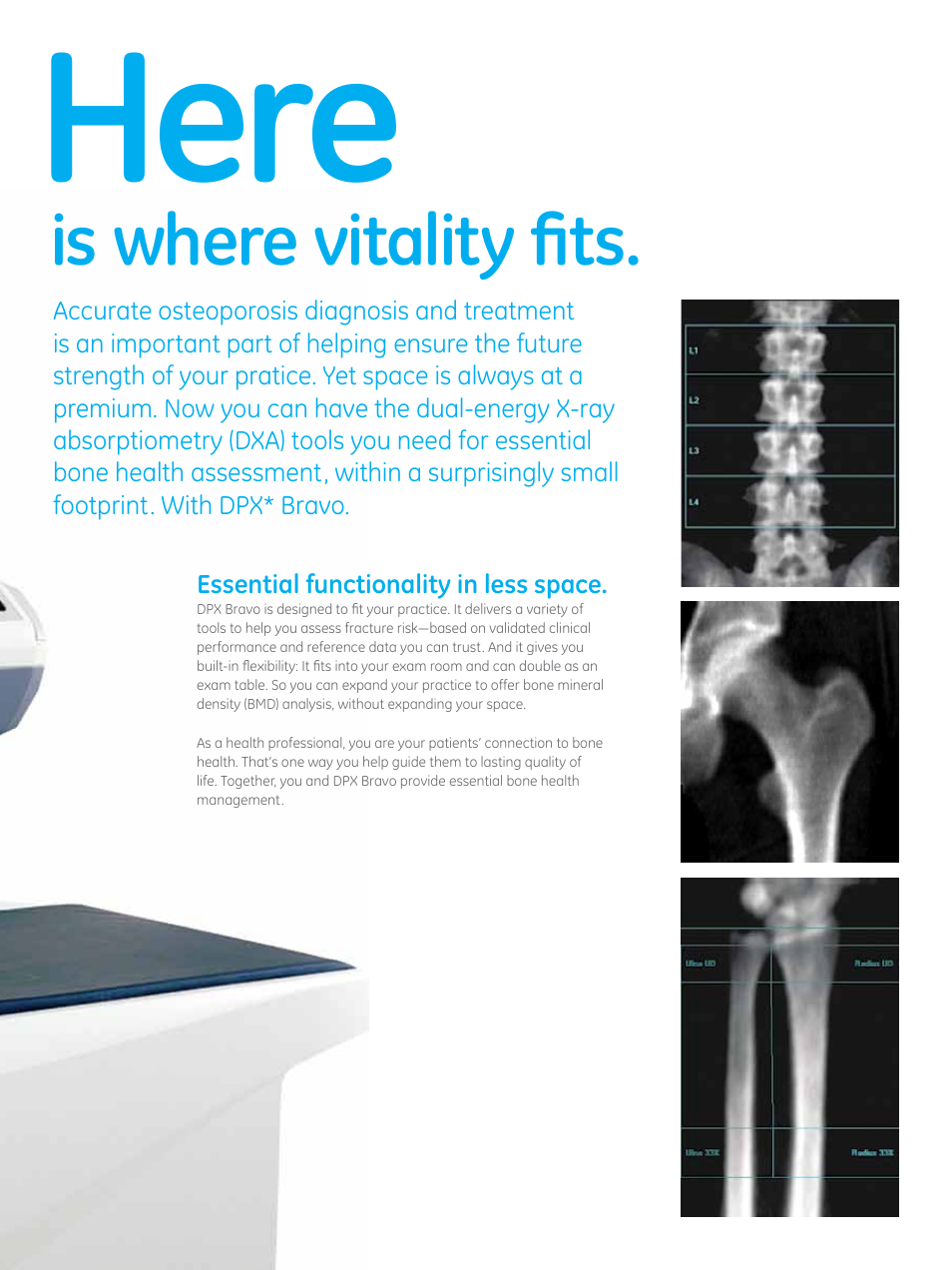 Here | GE Healthcare DPX Bravo User Manual | Page 3 / 8