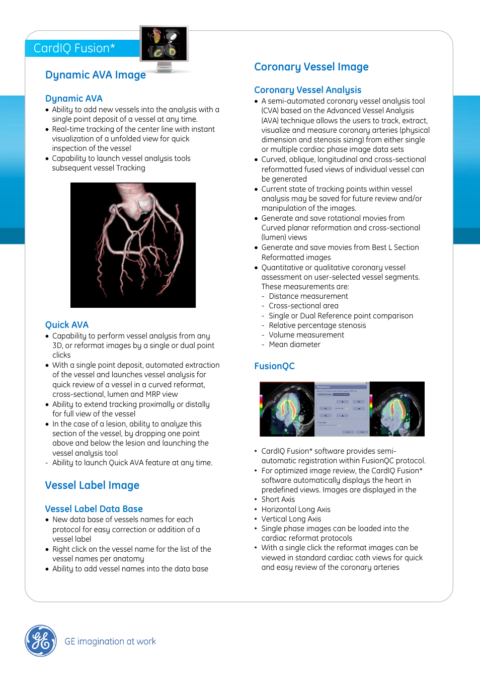 Cardiq fusion, Dynamic ava image, Vessel label image | Coronary vessel image | GE Healthcare CardIQ Fusion User Manual | Page 3 / 3