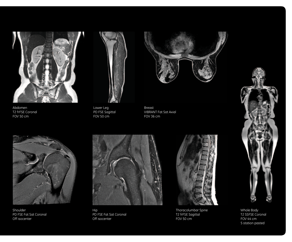 GE Healthcare Discovery MR750w User Manual | Page 11 / 12