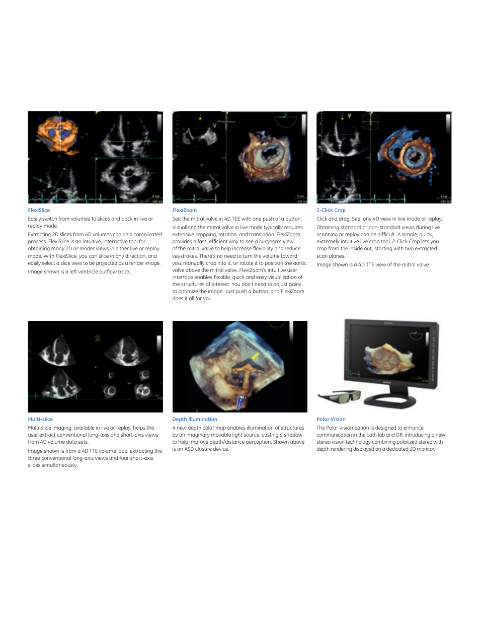 GE Healthcare Vivid E9 with XDclear User Manual | Page 7 / 8