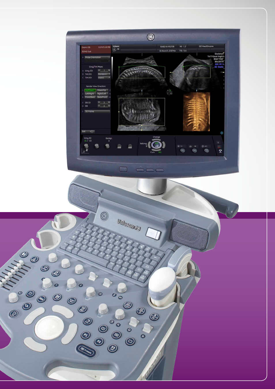 GE Healthcare Voluson Performance Series User Manual | Page 3 / 8