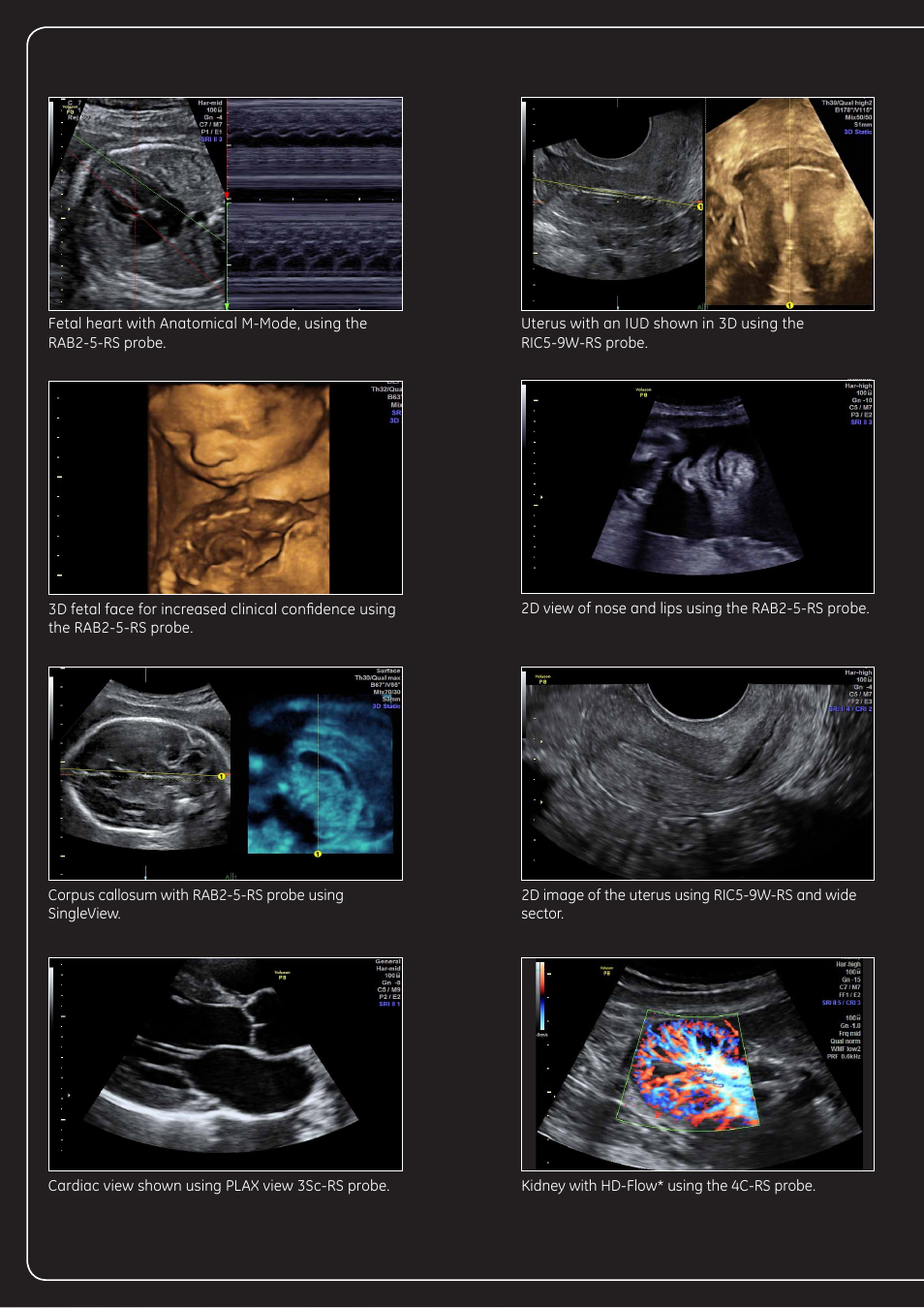 GE Healthcare Voluson Performance Series User Manual | Page 6 / 8