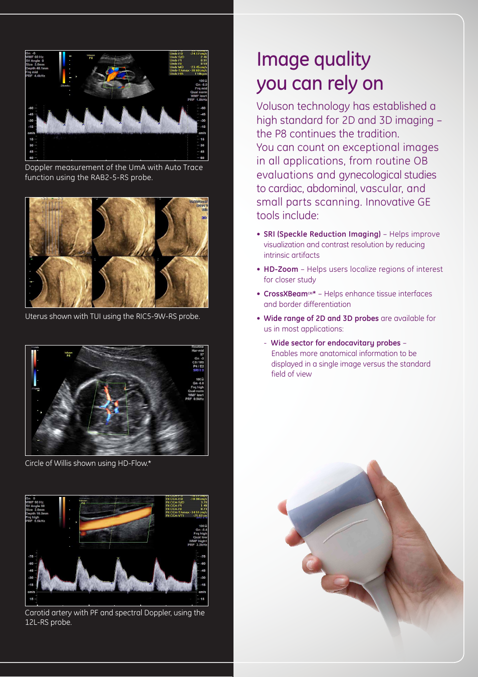 Image quality you can rely on | GE Healthcare Voluson Performance Series User Manual | Page 7 / 8