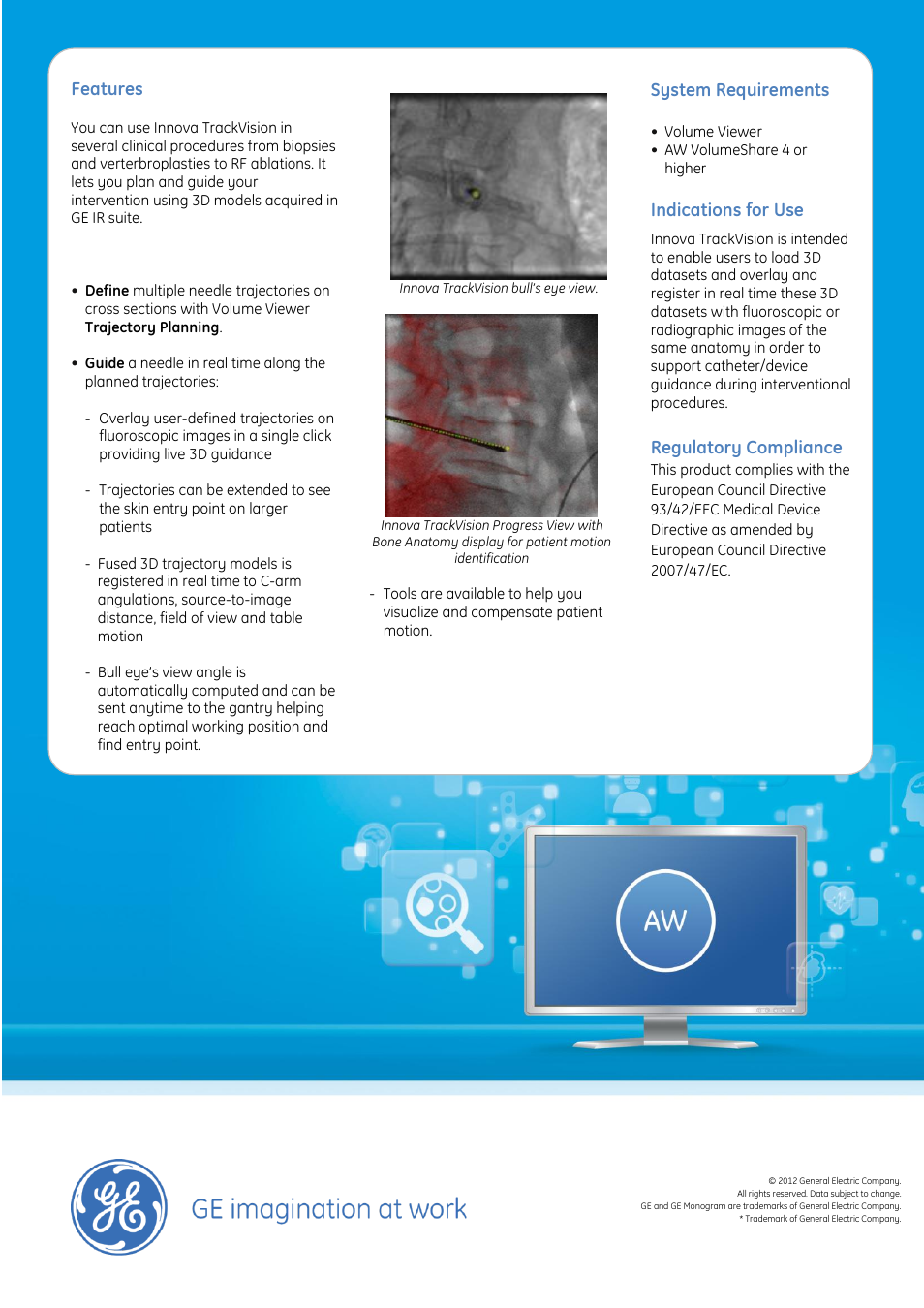 Features, System requirements, Indications for use | Regulatory compliance | GE Healthcare Innova TrackVision User Manual | Page 2 / 2