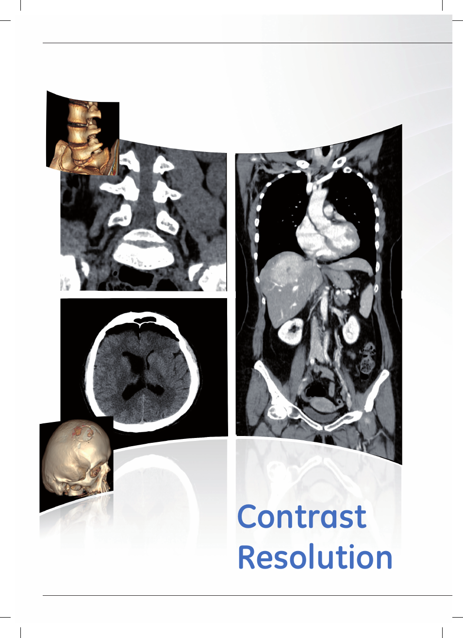 GE Healthcare Optima CT540 User Manual | Page 12 / 20