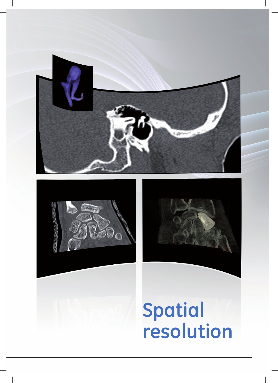 GE Healthcare Optima CT540 User Manual | Page 13 / 20