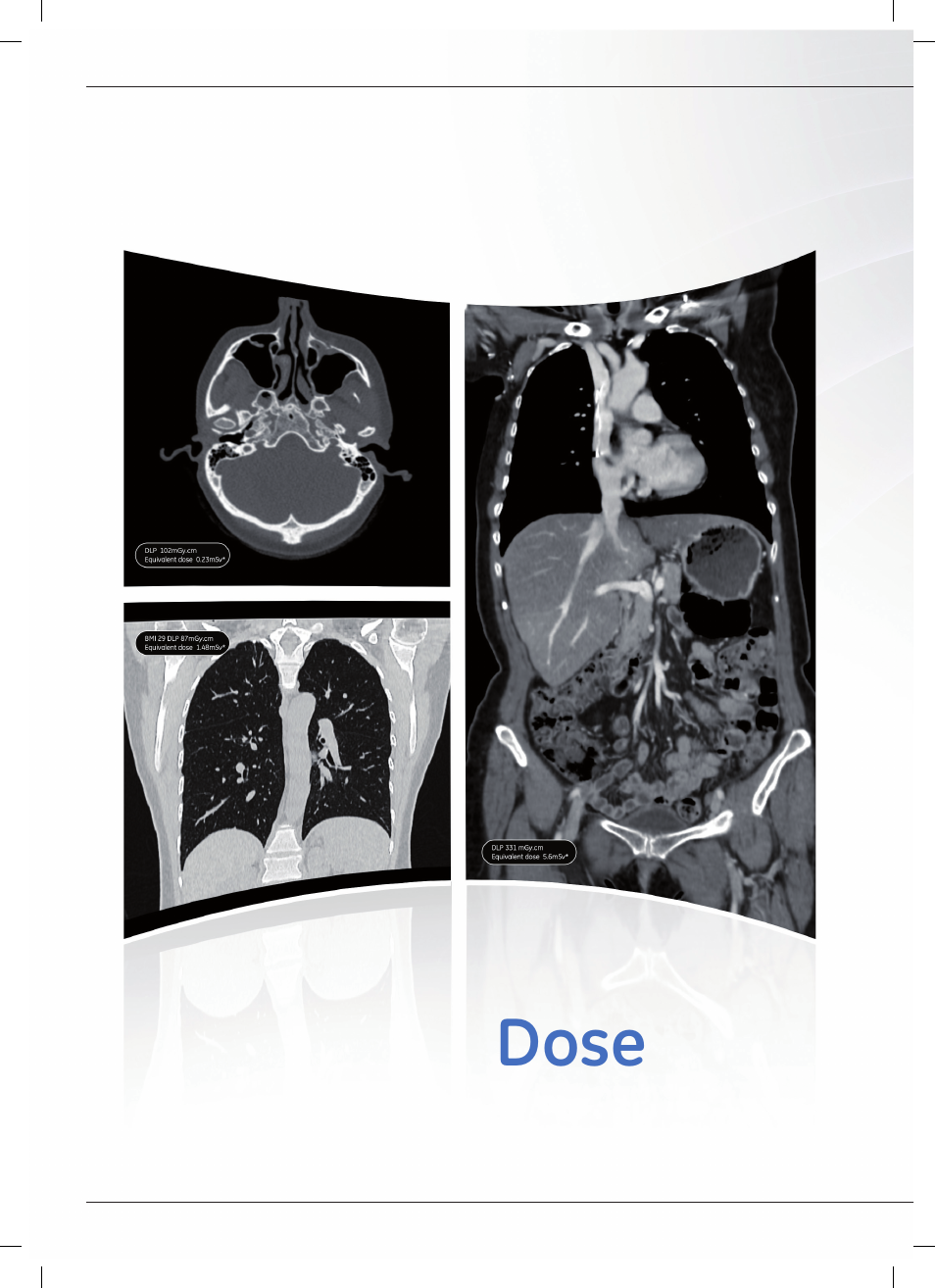 GE Healthcare Optima CT540 User Manual | Page 14 / 20