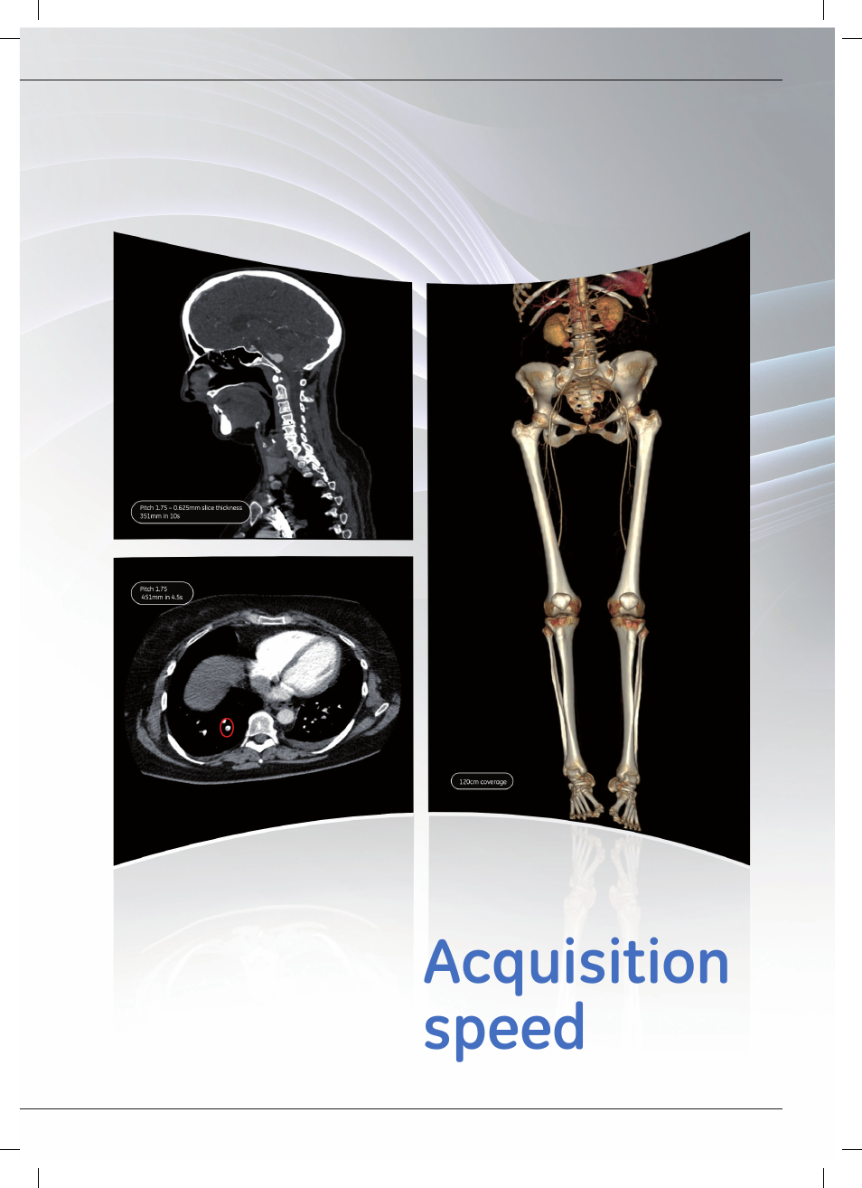 GE Healthcare Optima CT540 User Manual | Page 15 / 20