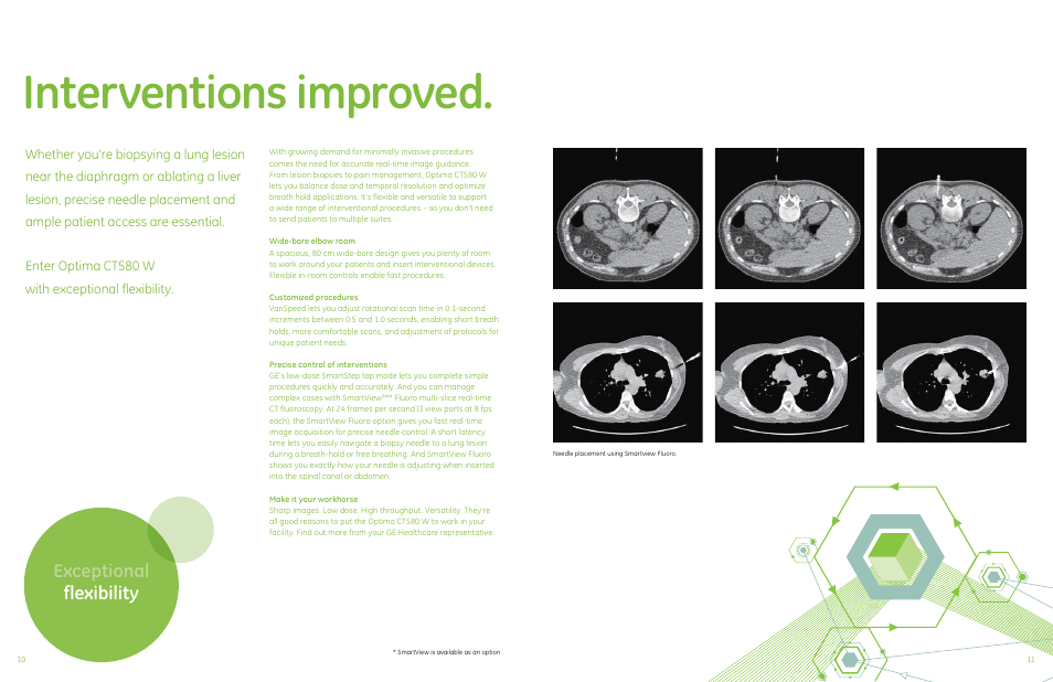 Interventions improved, Exceptional flexibility | GE Healthcare Optima CT580 W User Manual | Page 6 / 6