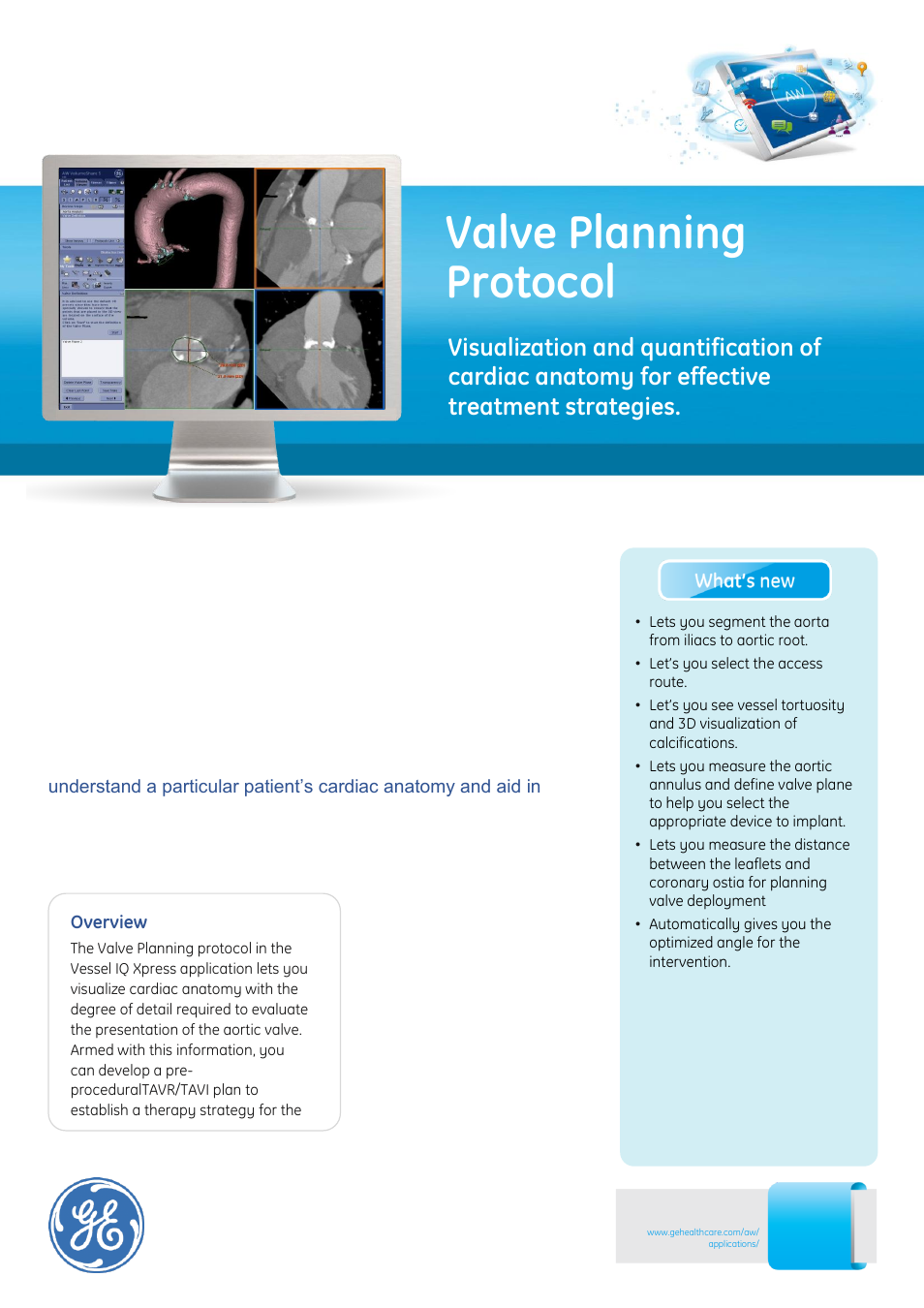 GE Healthcare Valve Planning Protocol User Manual | 2 pages