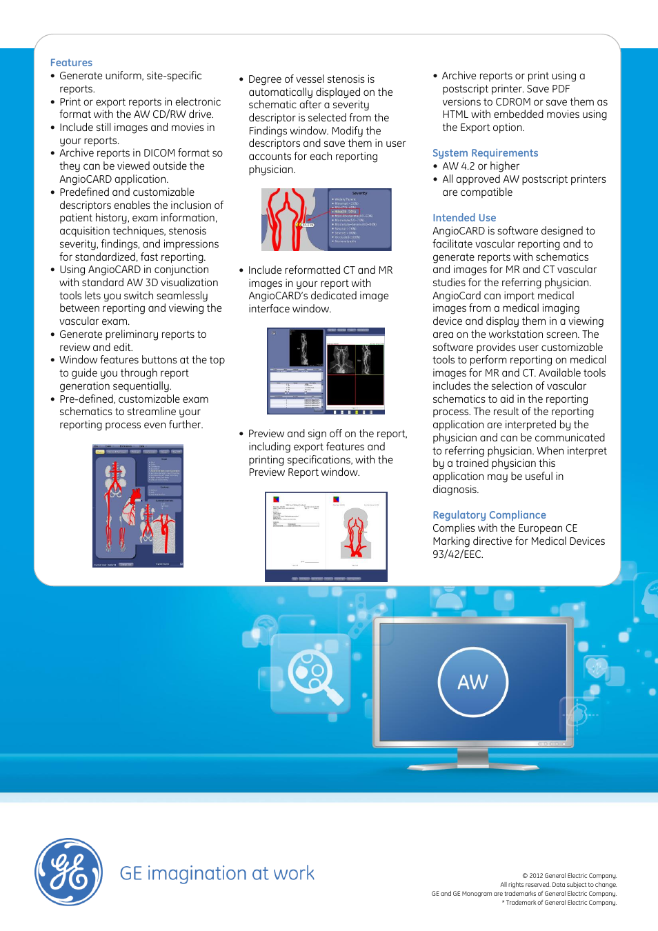GE Healthcare AngioCARD User Manual | Page 2 / 2