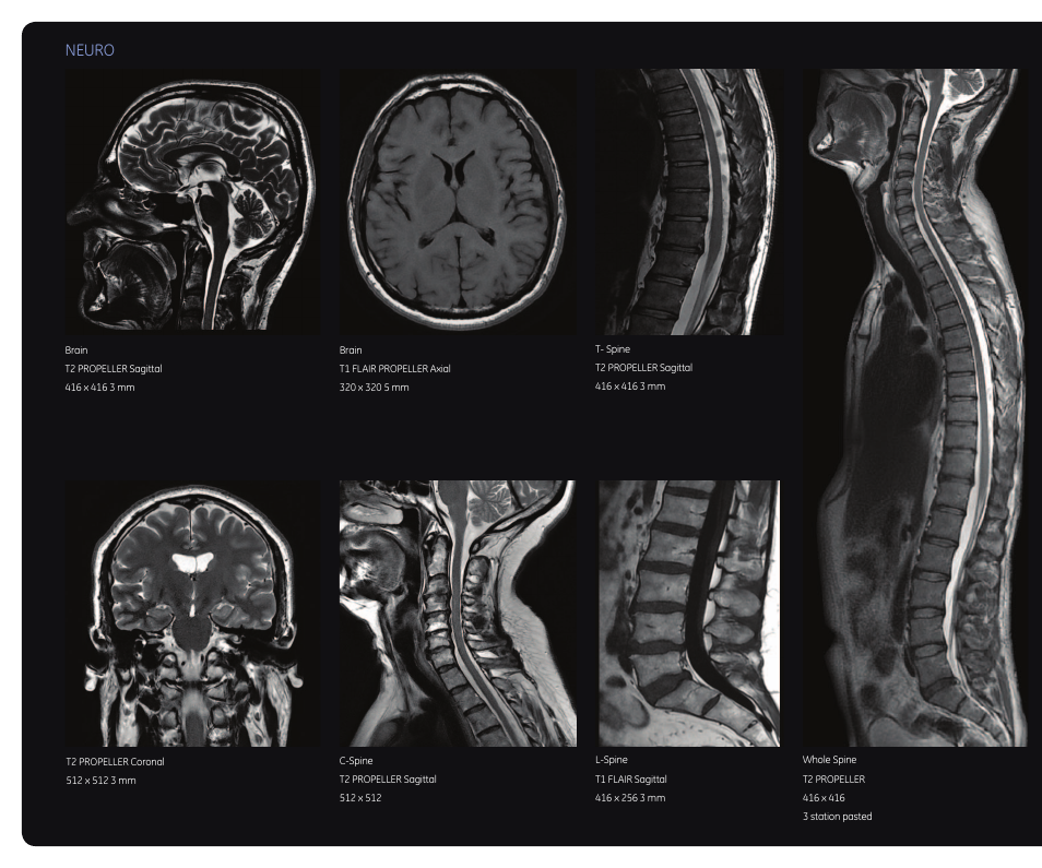 Neuro | GE Healthcare Discovery MR750w 3.0T User Manual | Page 12 / 20