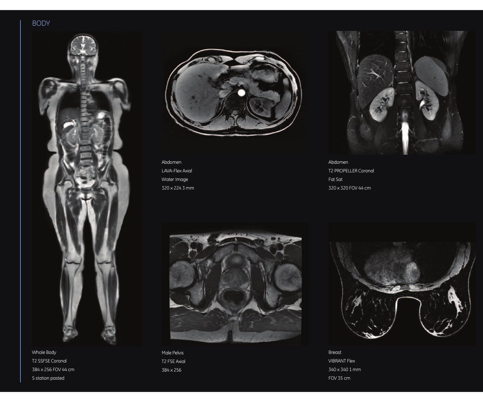 Body | GE Healthcare Discovery MR750w 3.0T User Manual | Page 14 / 20