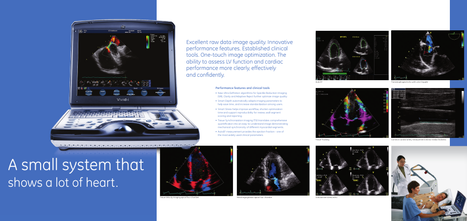 A small system that, Shows a lot of heart | GE Healthcare Vivid i User Manual | Page 4 / 6