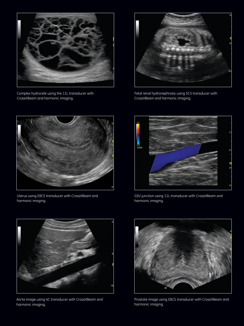 GE Healthcare LOGIQ P5 User Manual | Page 4 / 8