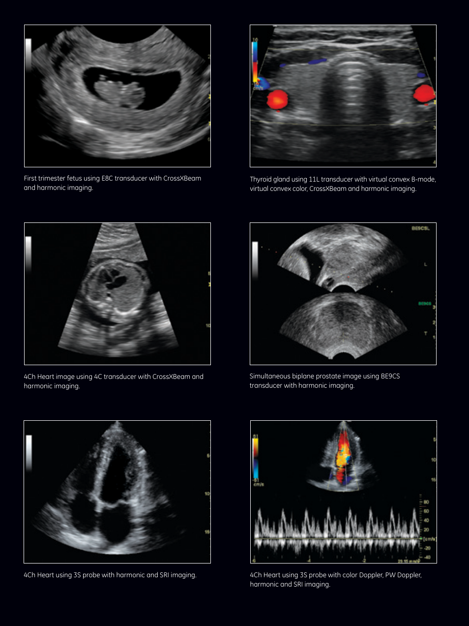 GE Healthcare LOGIQ P5 User Manual | Page 5 / 8