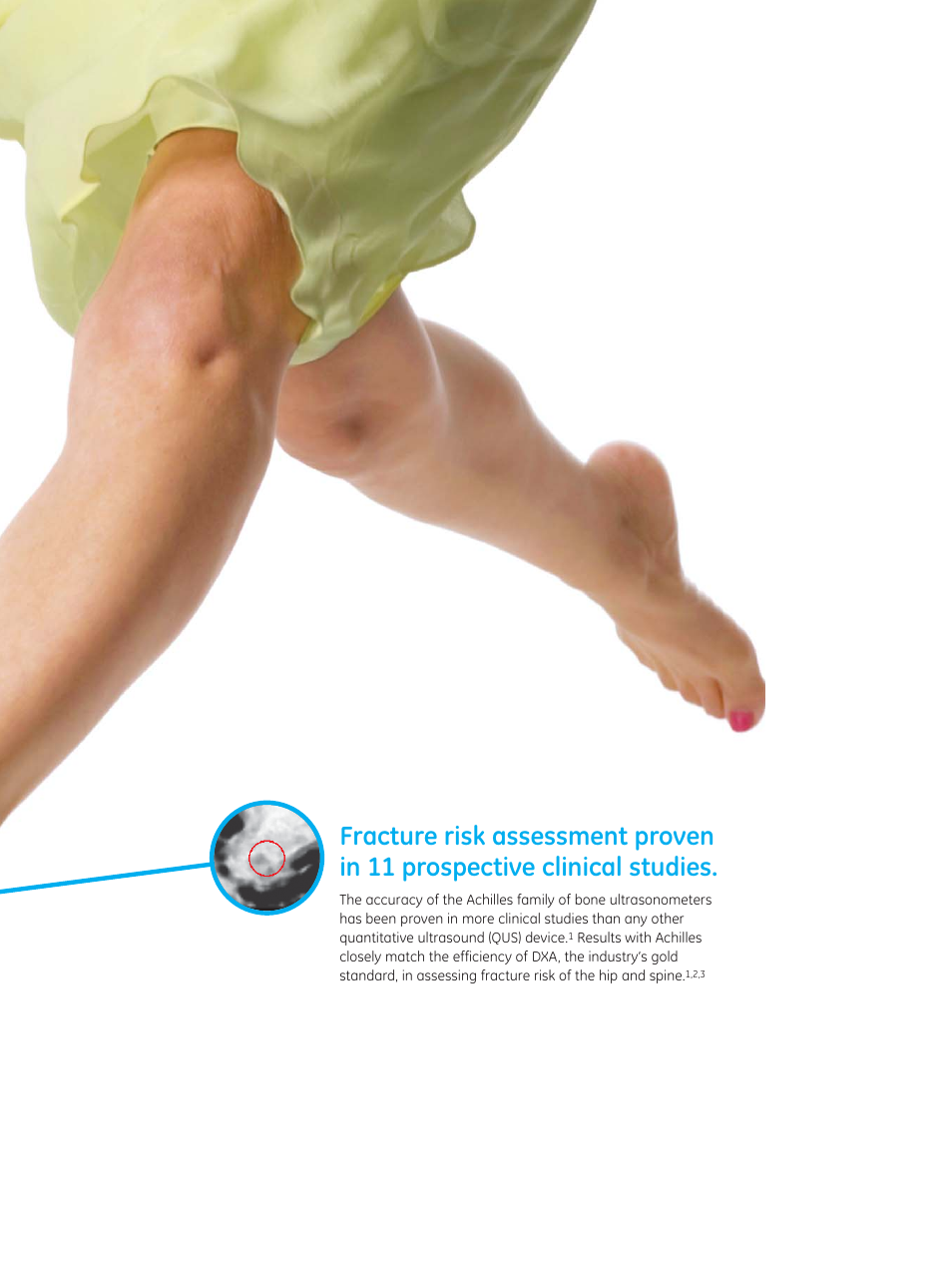 GE Healthcare Achilles User Manual | Page 3 / 8