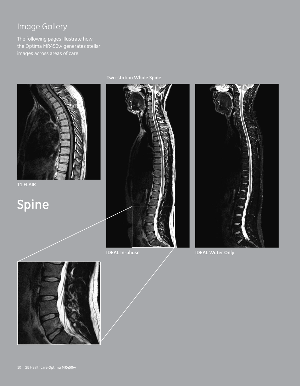 Spine, Image gallery | GE Healthcare Optima MR450w User Manual | Page 12 / 24