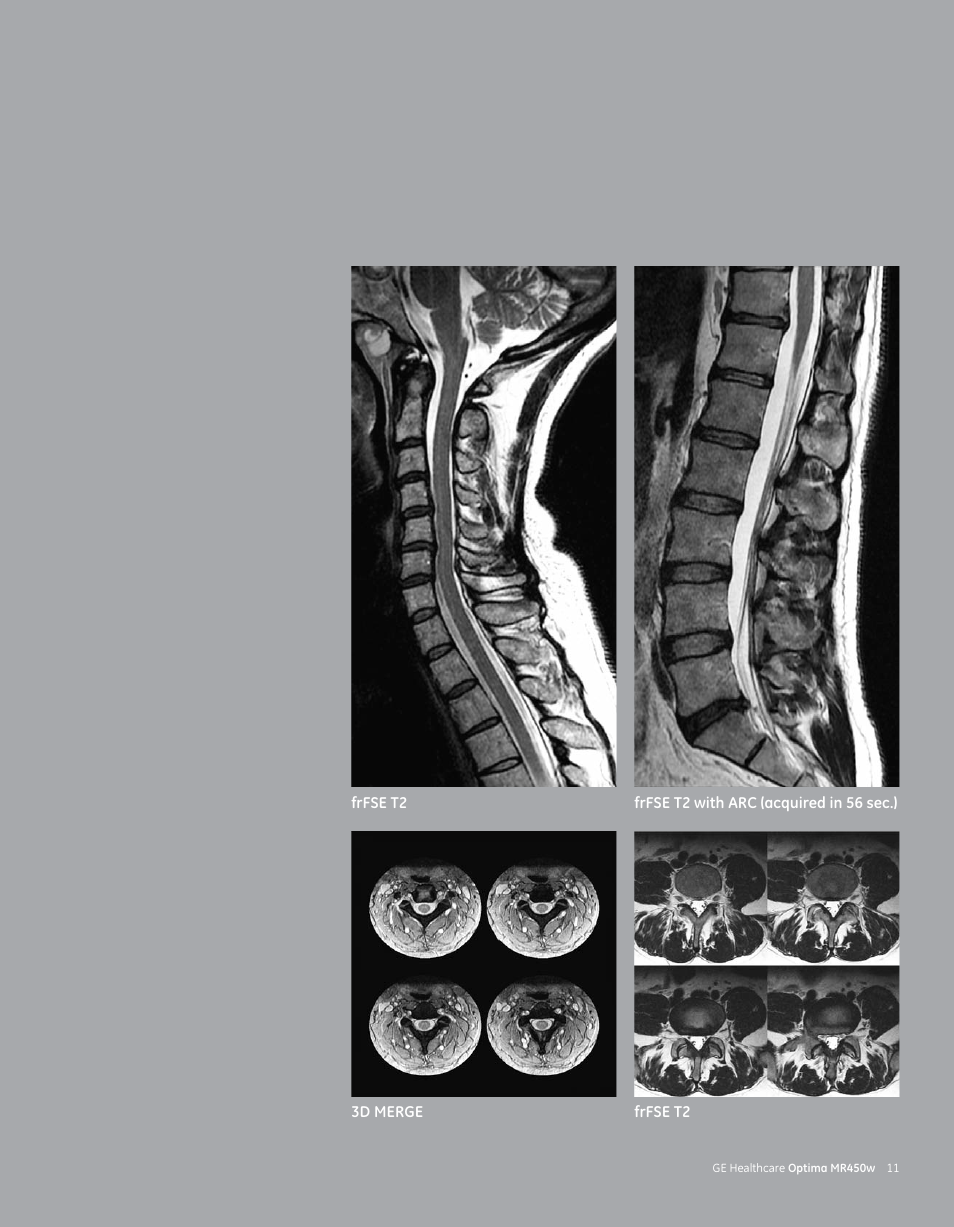 GE Healthcare Optima MR450w User Manual | Page 13 / 24