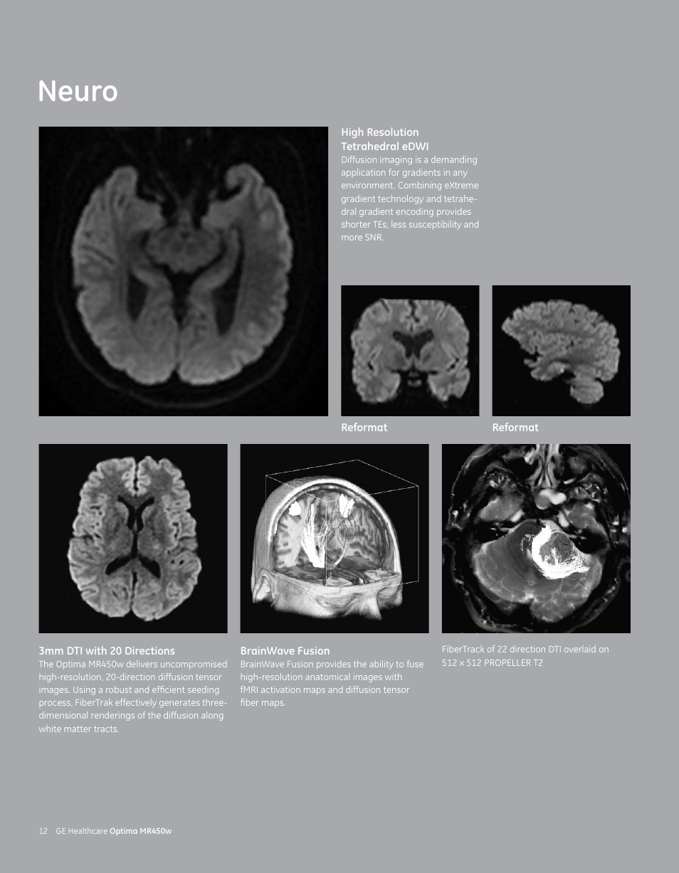 Neuro | GE Healthcare Optima MR450w User Manual | Page 14 / 24