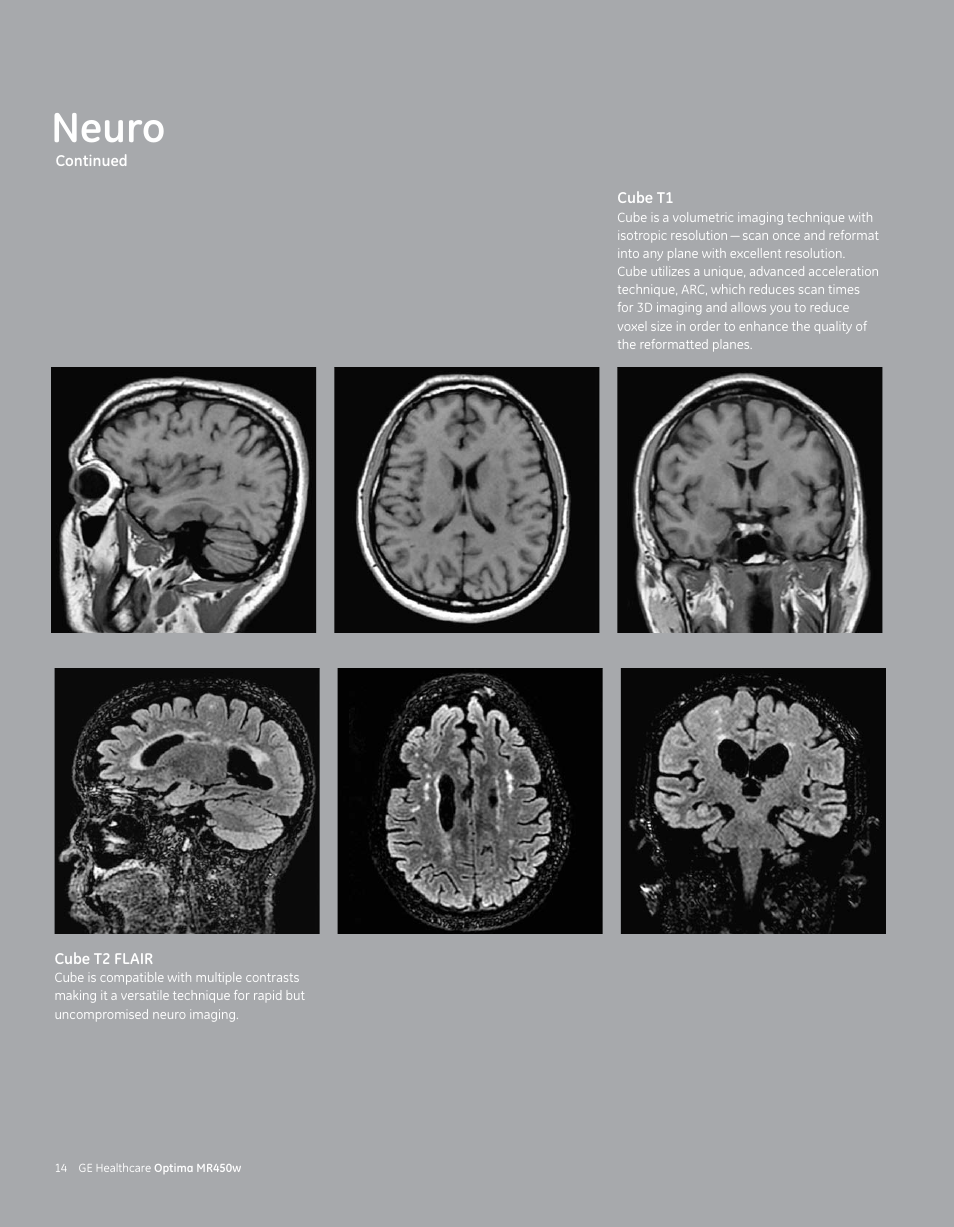 Neuro | GE Healthcare Optima MR450w User Manual | Page 16 / 24