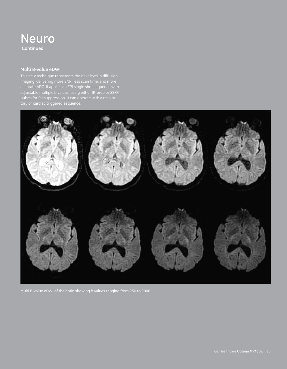 Neuro | GE Healthcare Optima MR450w User Manual | Page 17 / 24