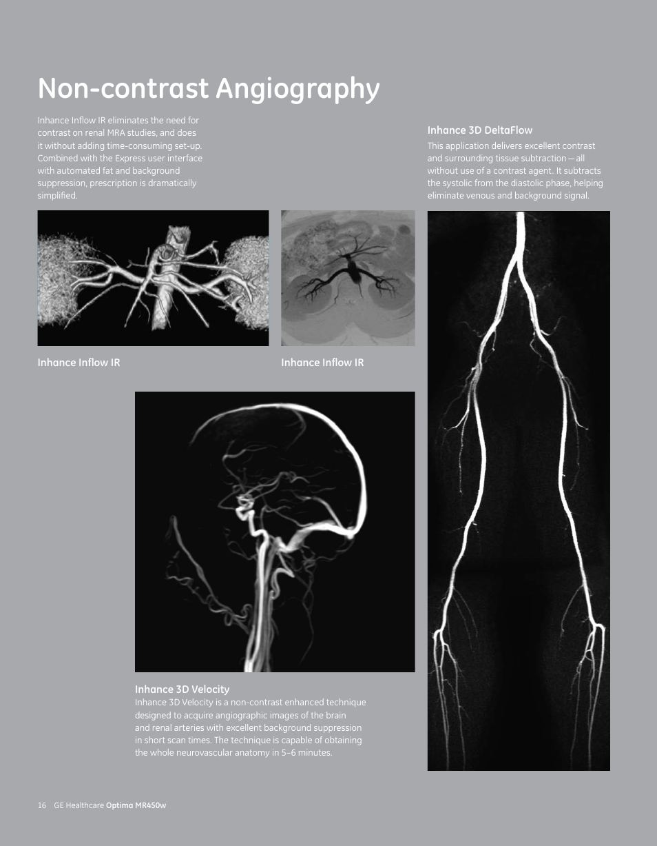 Non-contrast angiography | GE Healthcare Optima MR450w User Manual | Page 18 / 24