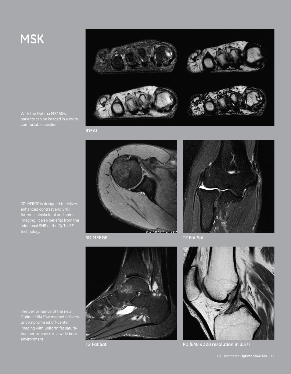 GE Healthcare Optima MR450w User Manual | Page 19 / 24