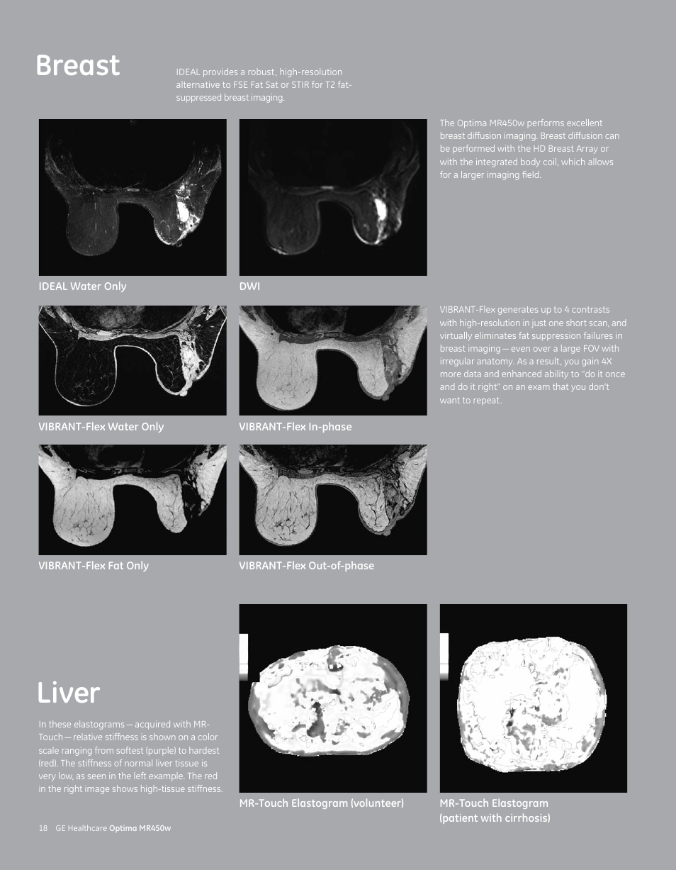 Breast, Liver | GE Healthcare Optima MR450w User Manual | Page 20 / 24