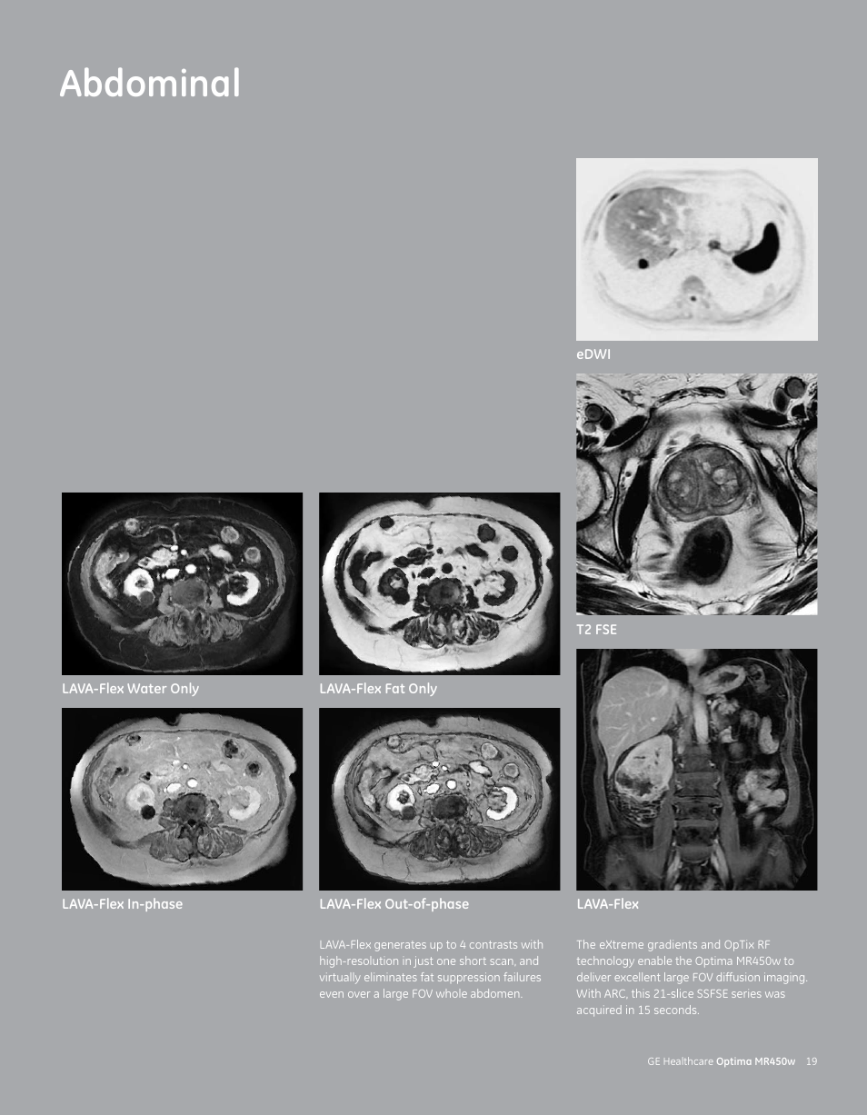 Abdominal | GE Healthcare Optima MR450w User Manual | Page 21 / 24