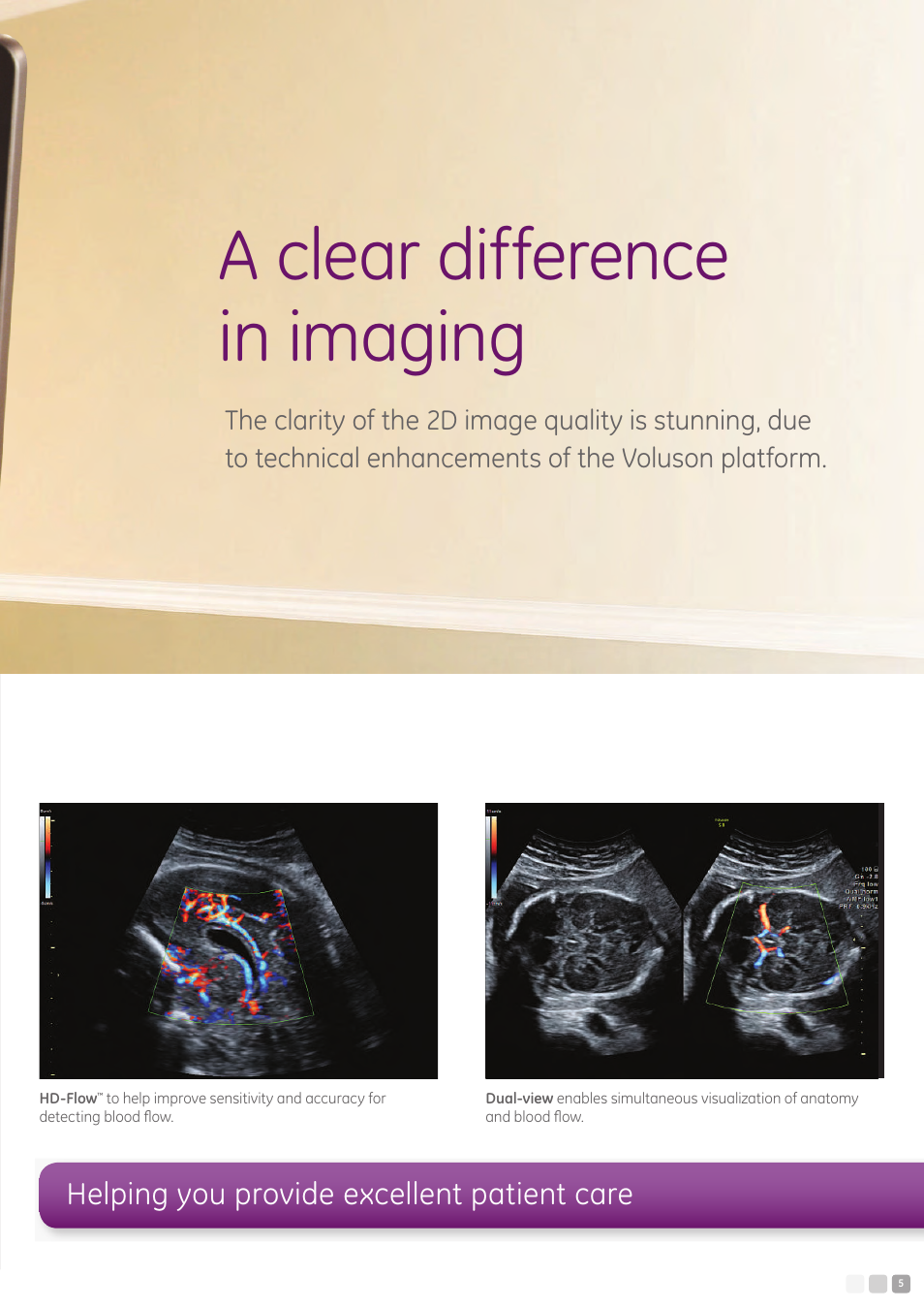 A clear difference in imaging, Helping you provide excellent patient care | GE Healthcare Voluson S8 User Manual | Page 5 / 12