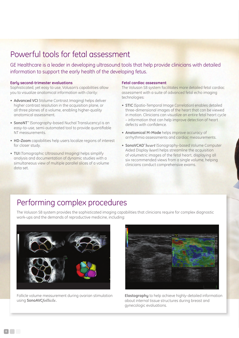 Powerful tools for fetal assessment, Performing complex procedures | GE Healthcare Voluson S8 User Manual | Page 6 / 12