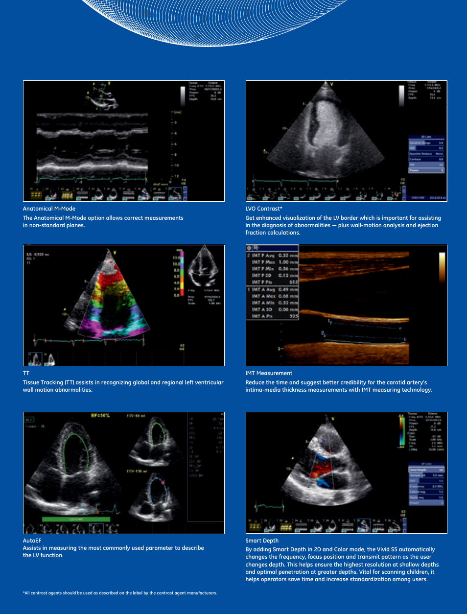 GE Healthcare Vivid S5 Cardiovascular ultrasound system User Manual | Page 4 / 8