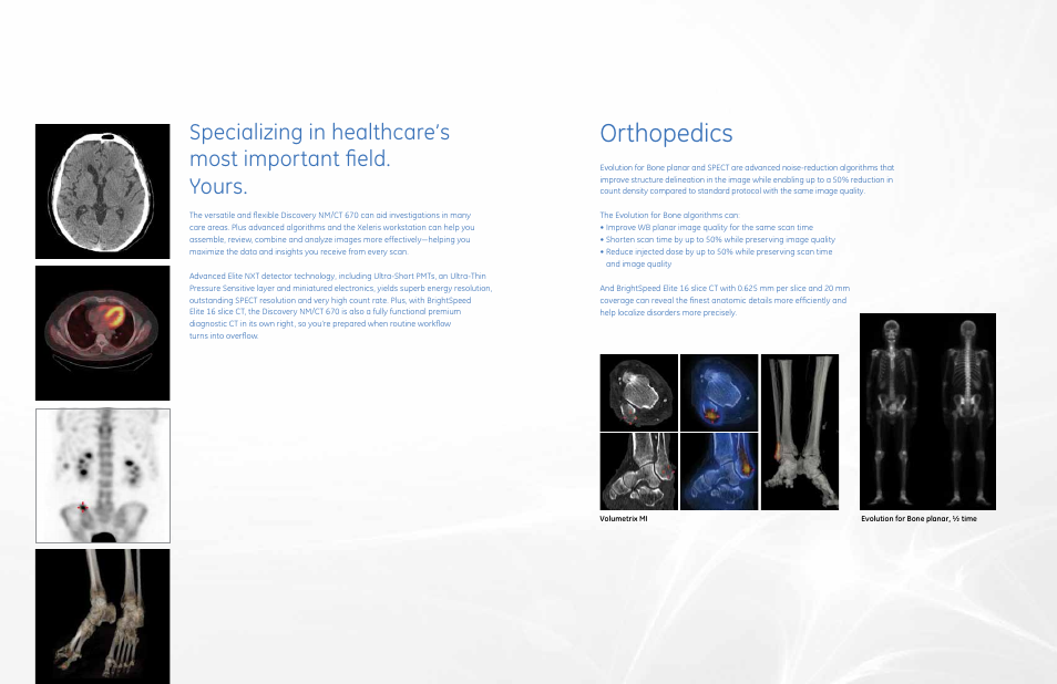 Orthopedics | GE Healthcare Discovery NM_CT 670 User Manual | Page 5 / 15