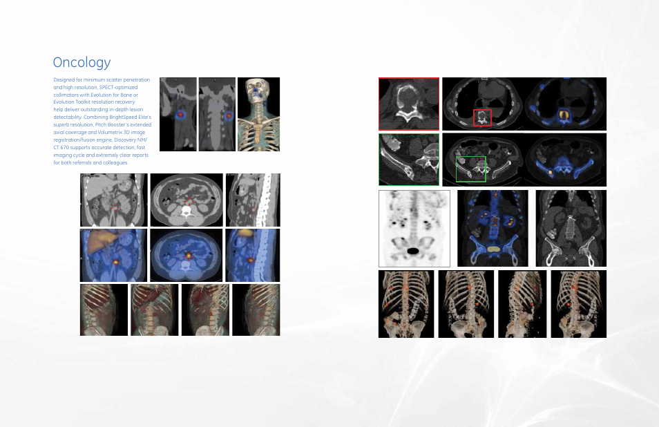 Oncology | GE Healthcare Discovery NM_CT 670 User Manual | Page 7 / 15