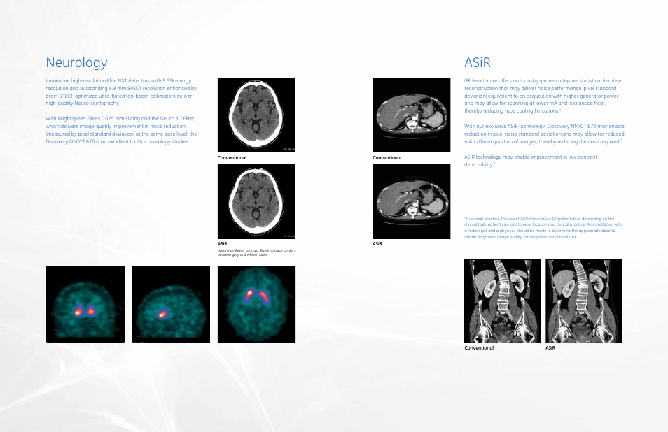 Asir, Neurology | GE Healthcare Discovery NM_CT 670 User Manual | Page 8 / 15