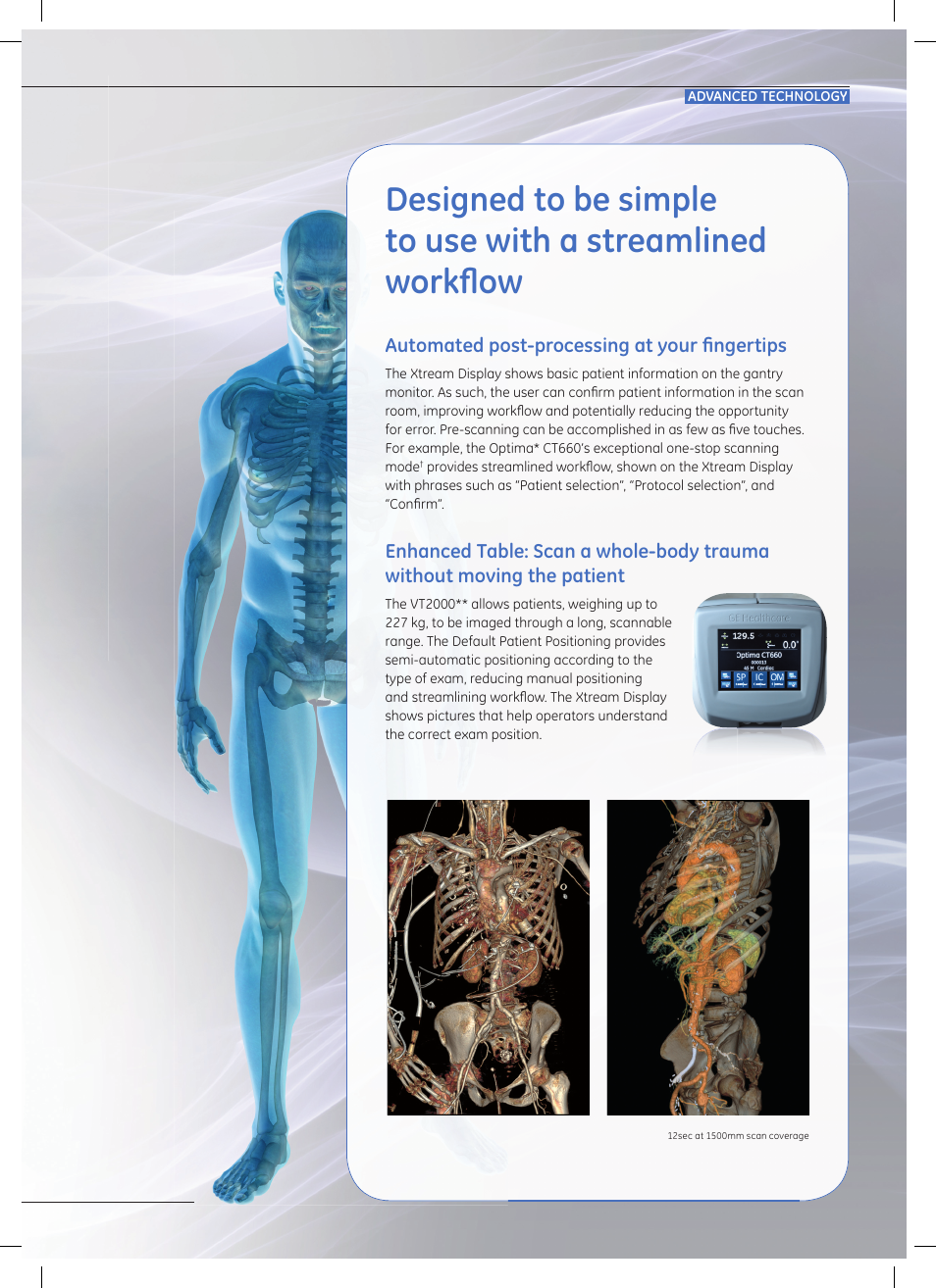 Emergency: when seconds count | GE Healthcare Optima CT660 User Manual | Page 5 / 18