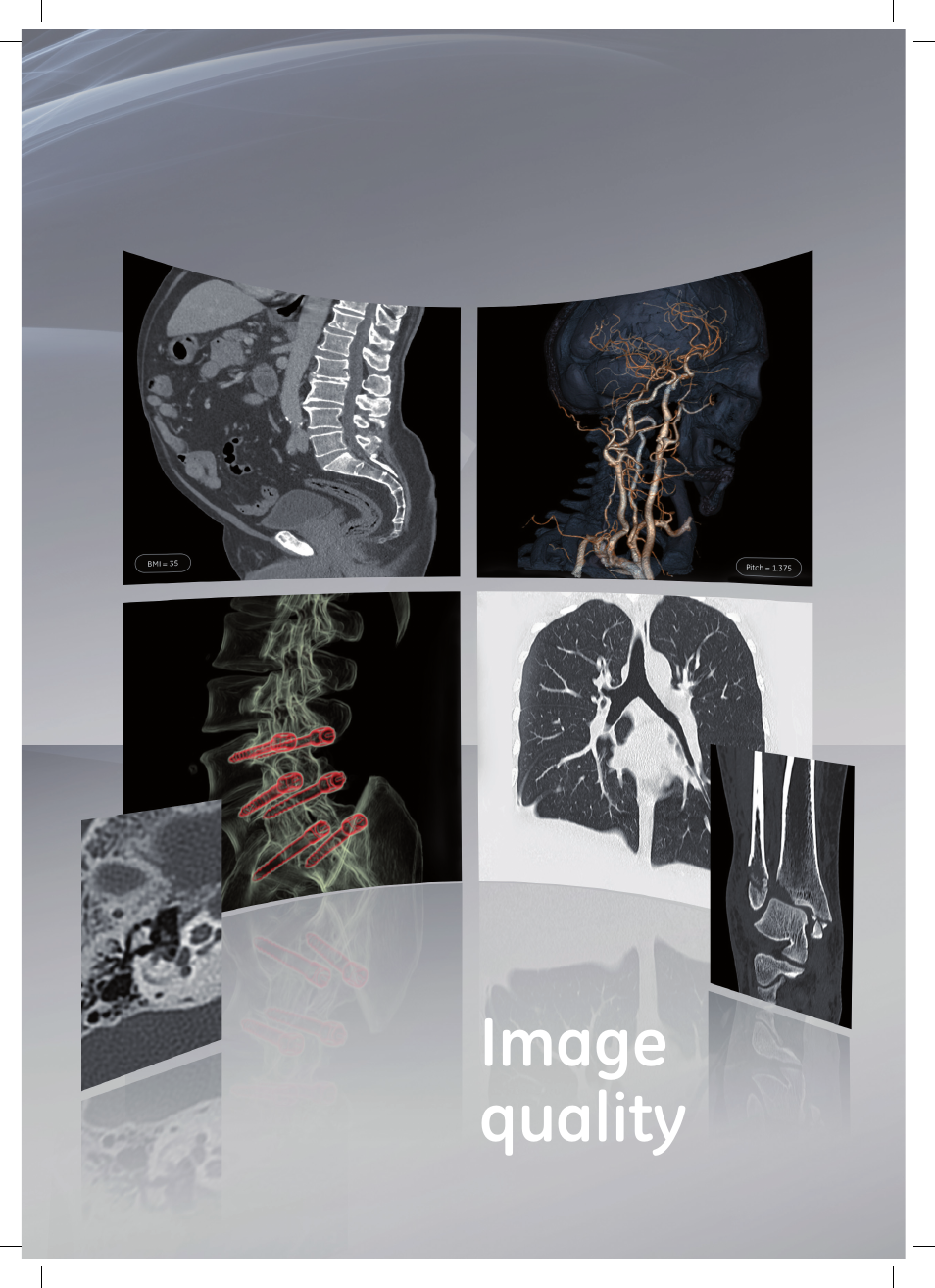 GE Healthcare Optima CT660 User Manual | Page 9 / 18
